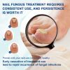 South Moon Nail Repair Pen, Repair Hands And Feet Gray Nails Brightening Nails Soft Nails Thickening Nails Moisturizing Care