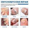 Ximonth Nail Fungus Patches, Repair Hand And Foot Nails Inlaid Nail Thickening Gray Nail Brightening Nail Patch