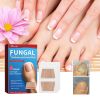 Ximonth Nighttime Renewal Fungal Nail Patches, Repair And Thickening Gray Nail Insert Soft Nail Care Patch