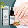 Ximonth Nail Care Spray Hand, Foot And Gray Nails Gentle Repair Bright Nails Soft Nails Moisturizing Treatment
